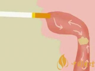 吸烟肺部有痰怎么办 抽烟肺里有痰的解决办法介绍！