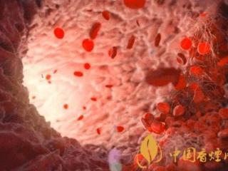血液浓稠有什么危害及症状 改善血液浓稠需及时戒烟戒酒