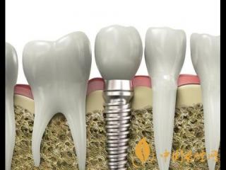 吸烟易导致口腔问题 电子烟也不例外！